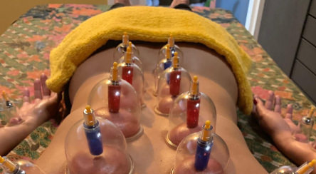 Massage Los Cristianos, Sak Thong Thai Massage and Therapy Tenerife - Cupping Therapy Massage