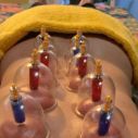 Massage Los Cristianos, Sak Thong Thai Massage and Therapy Tenerife, FAQ - Cupping Therapy Massage